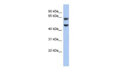 Western Blot: ZP1 Antibody [NBP2-84369]