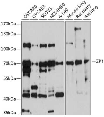 Western Blot: ZP1 AntibodyAzide and BSA Free [NBP2-94274]