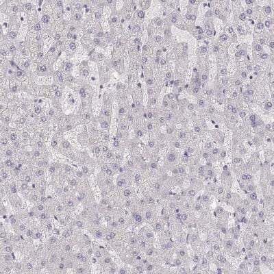 Immunohistochemistry-Paraffin: ZP3 Antibody [NBP2-30830]