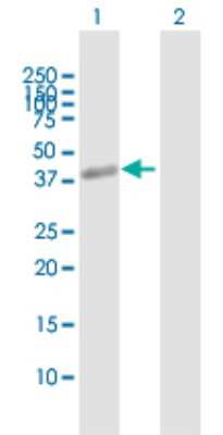 Western Blot: ZP3 Antibody [H00007784-B01P]