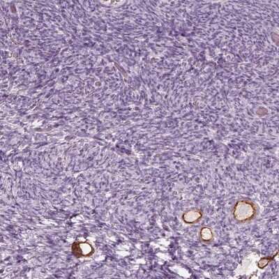 Immunohistochemistry-Paraffin: ZP4 Antibody [NBP1-86823]