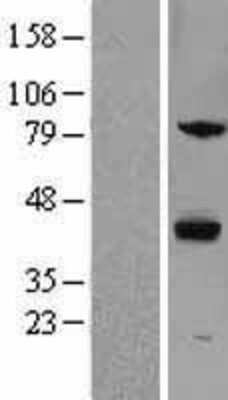 Western Blot: ZPBP Overexpression Lysate [NBL1-18264]