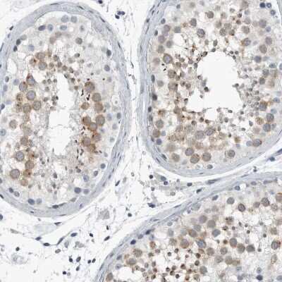 Immunohistochemistry-Paraffin: ZPBP2 Antibody [NBP1-82689]