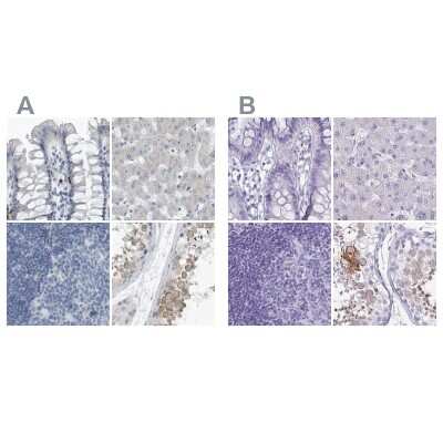 Immunohistochemistry-Paraffin: ZPBP2 Antibody [NBP1-82689]