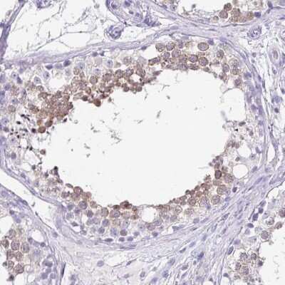 Immunohistochemistry-Paraffin: ZPBP2 Antibody [NBP2-33671]
