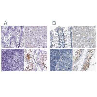 Immunohistochemistry-Paraffin: ZPBP2 Antibody [NBP2-33671]