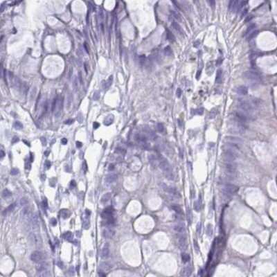 Immunohistochemistry-Paraffin: ZPBP2 Antibody [NBP2-33671]