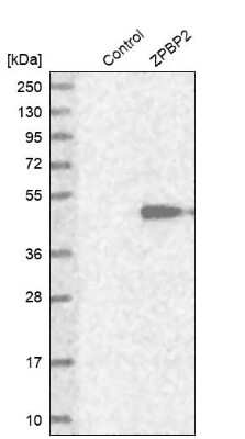 Western Blot: ZPBP2 Antibody [NBP1-82689]