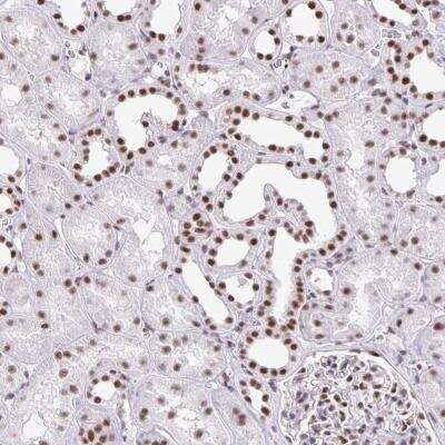 Immunohistochemistry-Paraffin: ZRANB2 Antibody [NBP2-32378]