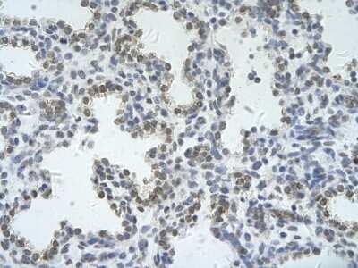 Immunohistochemistry: ZRSR2 Antibody [NBP1-57317]