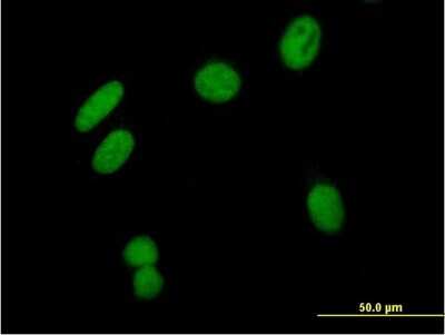 Immunocytochemistry/ Immunofluorescence: ZSCAN16 Antibody [H00080345-B01P]