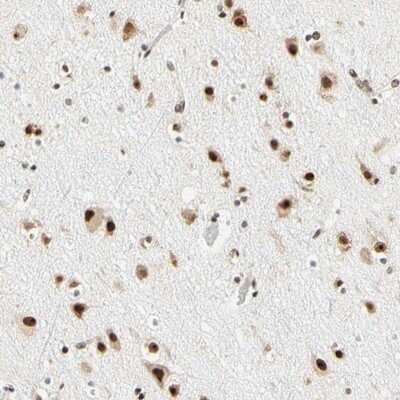 Immunohistochemistry-Paraffin: ZSCAN16 Antibody [NBP1-85184]