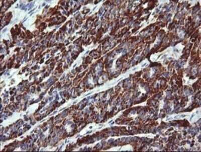 Immunohistochemistry: ZSCAN21/ZFP38 Antibody (OTI2E5) - Azide and BSA Free [NBP2-74956]