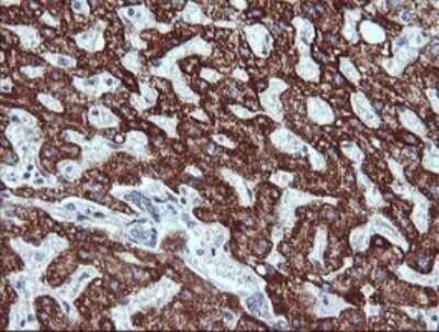 Immunohistochemistry: ZSCAN21/ZFP38 Antibody (OTI2E5) - Azide and BSA Free [NBP2-74956]