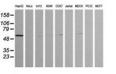 Western Blot: ZSCAN21/ZFP38 Antibody (OTI2E5)Azide and BSA Free [NBP2-74956]
