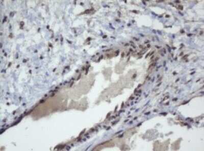Immunohistochemistry: ZSCAN4 Antibody (OTI1A6) [NBP2-45473]