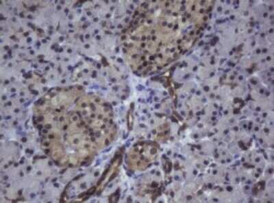 Immunohistochemistry: ZSCAN4 Antibody (OTI1A6) [NBP2-45473]