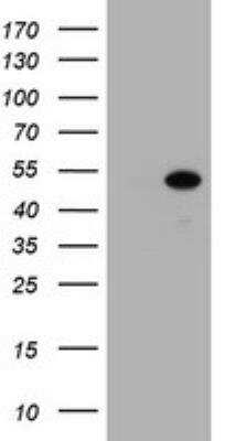 Western Blot: ZSCAN4 Antibody (OTI1A6) [NBP2-45473]