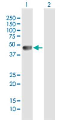 Western Blot: ZSCAN4 Antibody [H00201516-B01P]