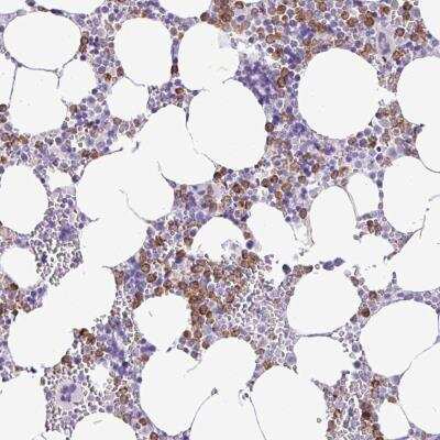 Immunohistochemistry: ZSCAN5 Antibody [NBP2-46692]