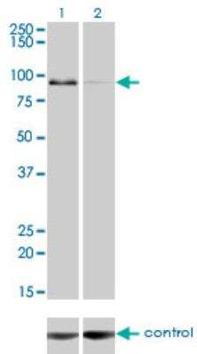 Western Blot: ZW10 Antibody (2E5) [H00009183-M05]