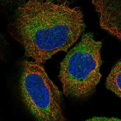 Immunocytochemistry/ Immunofluorescence: ZW10 Antibody [NBP2-38644]