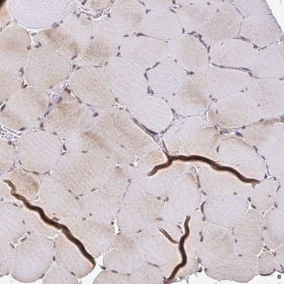 Immunohistochemistry-Paraffin: ZW10 Antibody [NBP2-38751]