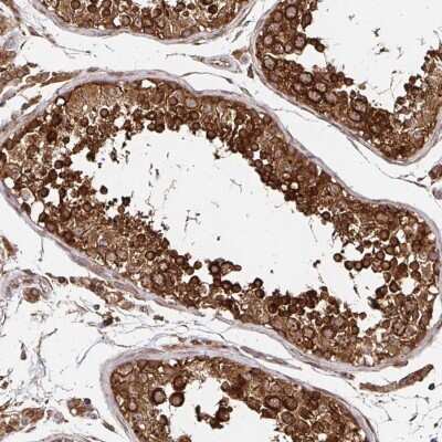 Immunohistochemistry-Paraffin: ZW10 Antibody [NBP2-38751]