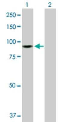 Western Blot: ZW10 Antibody [H00009183-D01P]