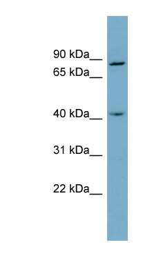 Western Blot: ZW10 Antibody [NBP1-55252]