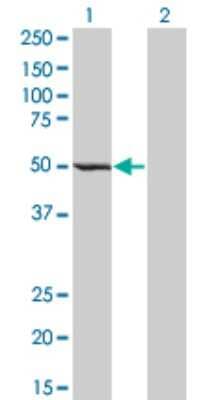 Western Blot: ZWILCH Antibody (1C9) [H00055055-M01]