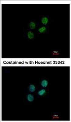 Immunocytochemistry/ Immunofluorescence: ZWILCH Antibody [NBP2-21057]