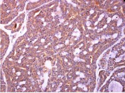 Immunohistochemistry-Paraffin: ZWILCH Antibody [NBP2-21057]