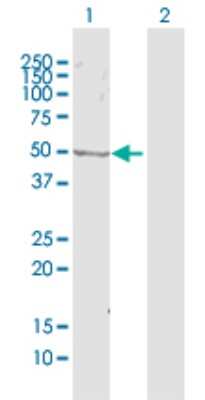Western Blot: ZWILCH Antibody [H00055055-D01P]