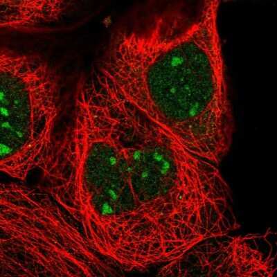 Immunocytochemistry/ Immunofluorescence: ZXDC Antibody [NBP2-56684]