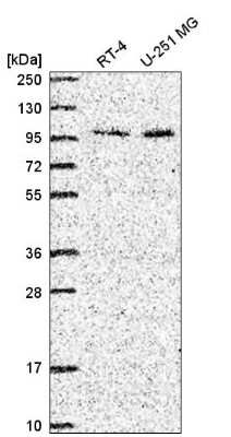 Western Blot: ZXDC Antibody [NBP2-56684]