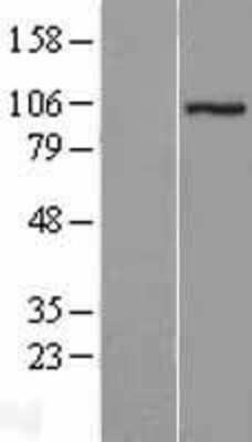 Western Blot: ZZZ3 Overexpression Lysate [NBL1-18280]