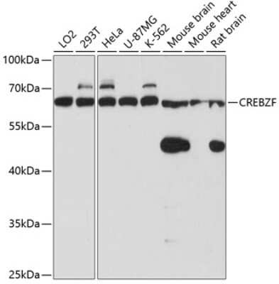Western Blot: Zhangfei AntibodyAzide and BSA Free [NBP2-94859]