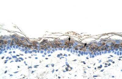 Immunohistochemistry: Zic2 Antibody [NBP2-86425]
