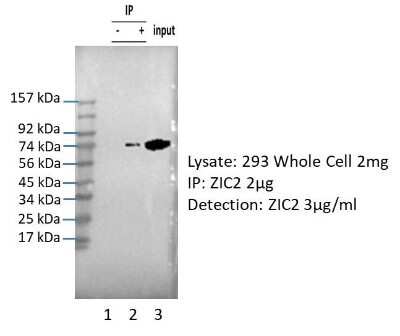 Immunoprecipitation: Zic2 Antibody [NBP2-86425]