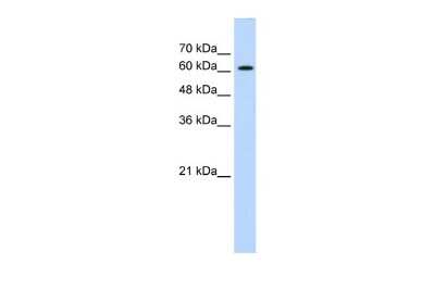 Western Blot: Zic2 Antibody [NBP2-86425]
