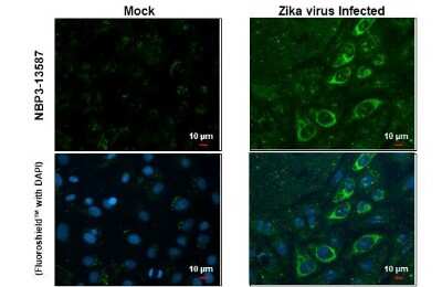Immunocytochemistry/ Immunofluorescence: Zika Virus (H/PF/2013) Envelope Antibody (GT363) [NBP3-13587]