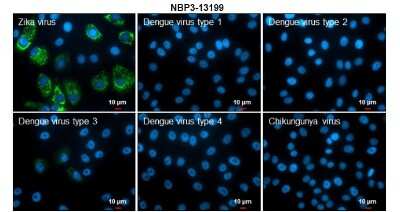 Immunocytochemistry/ Immunofluorescence: Zika Virus (H/PF/2013) Envelope Antibody [NBP3-13199]