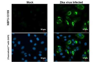 Immunocytochemistry/ Immunofluorescence: Zika Virus (H/PF/2013) Envelope Antibody [NBP3-13199]