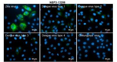 Immunocytochemistry/ Immunofluorescence: Zika Virus (H/PF/2013) Envelope Antibody [NBP3-13206]