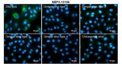 Immunocytochemistry/ Immunofluorescence: Zika virus NS3 Antibody [NBP3-13196]
