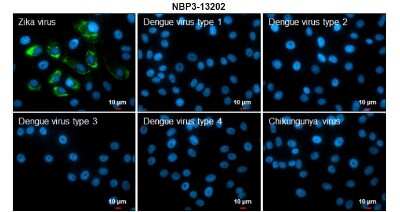 Immunocytochemistry/ Immunofluorescence: Zika virus NS3 Antibody [NBP3-13202]