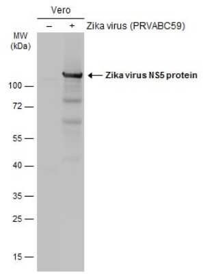 Western Blot: Zika virus NS5 Antibody [NBP3-13207]