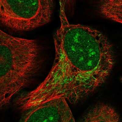 Immunocytochemistry/ Immunofluorescence: Zinc finger and BTB domain-containing protein 9 Antibody [NBP1-92611]