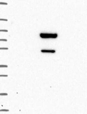 Western Blot: Zinc finger and BTB domain-containing protein 9 Antibody [NBP3-17965]